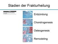 Abbildung 9: Osteoporosetherapie