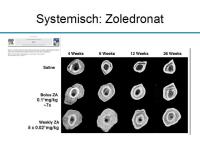 Abbildung 11: Osteoporosetherapie