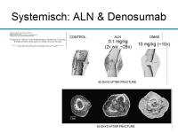 Abbildung 12: Osteoporosetherapie