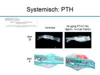 Abbildung 16: Osteoporosetherapie