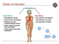 Abbildung 17: Raloxifen