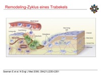 Abbildung 18: Raloxifen