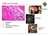 Abbildung 20: Raloxifen