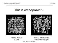 Abbildung 3: Osteoporose