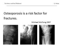 Abbildung 5: Osteoporose