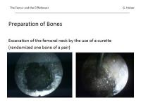 Abbildung 16: Osteoporose
