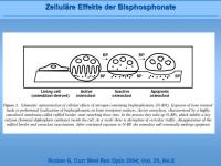 Abbildung 4: Fosamax