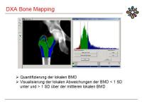 Abbildung 34: DXA