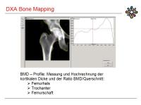 Abbildung 35: DXA