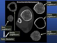 Abbildung 10: Mikrokosmos Knochen