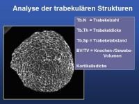 Abbildung 11: Mikrokosmos Knochen