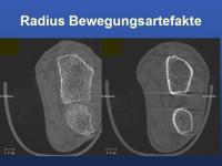 Abbildung 13: Mikrokosmos Knochen