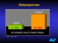 Abbildung 8: Osteoporotische Fraktur