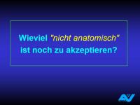Abbildung 102: Osteoporotische Fraktur