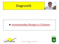 Abbildung 7: Osteoporotische Refraktur