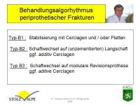 Abbildung 12: Osteoporotische Refraktur