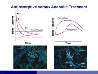 Abbildung 8: Osteoporose