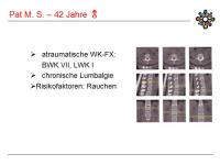 Abbildung 39: PTH 1-84