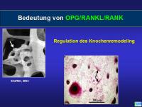 Abbildung 1: Knochenremodeling