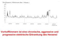 Abbildung 4: Vorhofflimmern