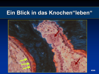 Abbildung 18: Vitamin D - Kalzium