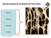 Abbildung 5: Osteoporose