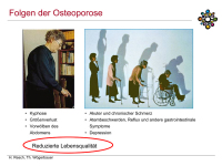 Abbildung 10: Osteoporose