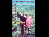 Abbildung 16: Osteoporose