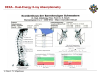 Abbildung 23: Osteoporose