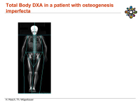 Abbildung 24: Osteoporose