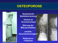 Abbildung 2: Osteoporose - Medikament�se Therapie