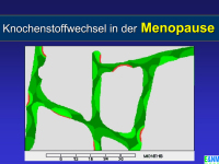 Abbildung 9: Osteoporose - Medikament�se Therapie