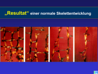 Abbildung 11: Osteoporose - Medikament�se Therapie