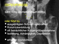 Abbildung 12: Osteoporose - Medikament�se Therapie