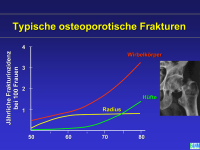 Abbildung 15: Osteoporose - Medikament�se Therapie