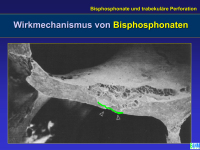 Abbildung 38: Osteoporose - Medikament�se Therapie