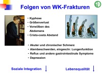 Abbildung 57: Frakturrisiko - �sterreich