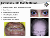 Abbildung 3: Osteogenesis imperfecta