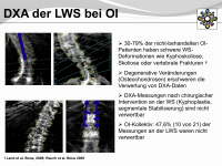 Abbildung 5: Osteogenesis imperfecta
