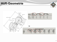 Abbildung 6: Osteogenesis imperfecta
