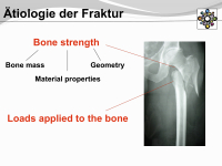 Abbildung 7: Osteogenesis imperfecta