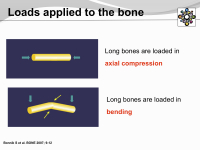 Abbildung 8: Osteogenesis imperfecta