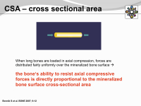 Abbildung 9: Osteogenesis imperfecta
