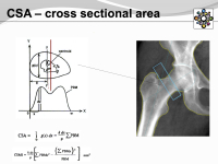 Abbildung 10: Osteogenesis imperfecta