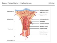 Abbildung 9: Bisphosphonates