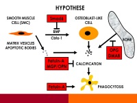 Abbildung 11: Osteoporose