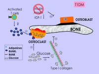 Abbildung 16: Osteoporose