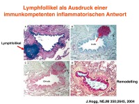 Abbildung 8: COPD - Osteoporose