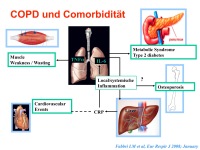 Abbildung 18: COPD - Osteoporose