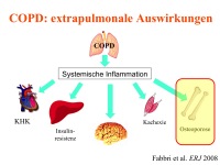 Abbildung 38: COPD - Osteoporose